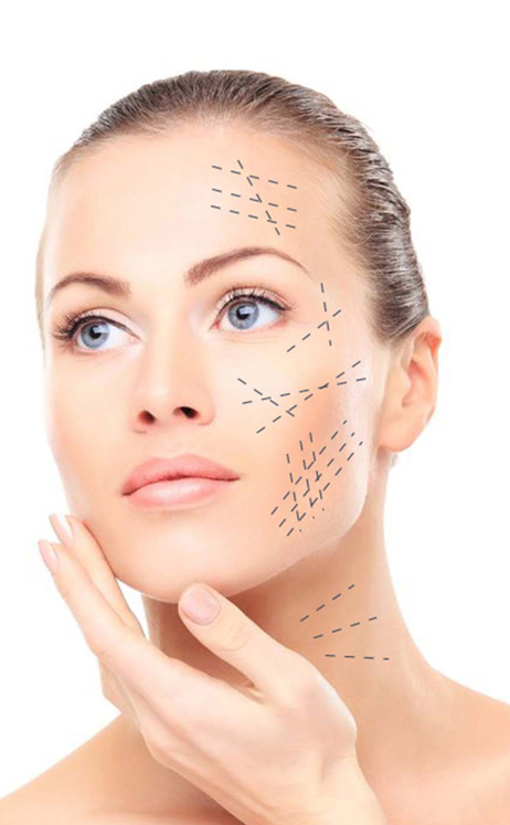 Imagen noticia HILOS TENSORES: MANUAL DE USO