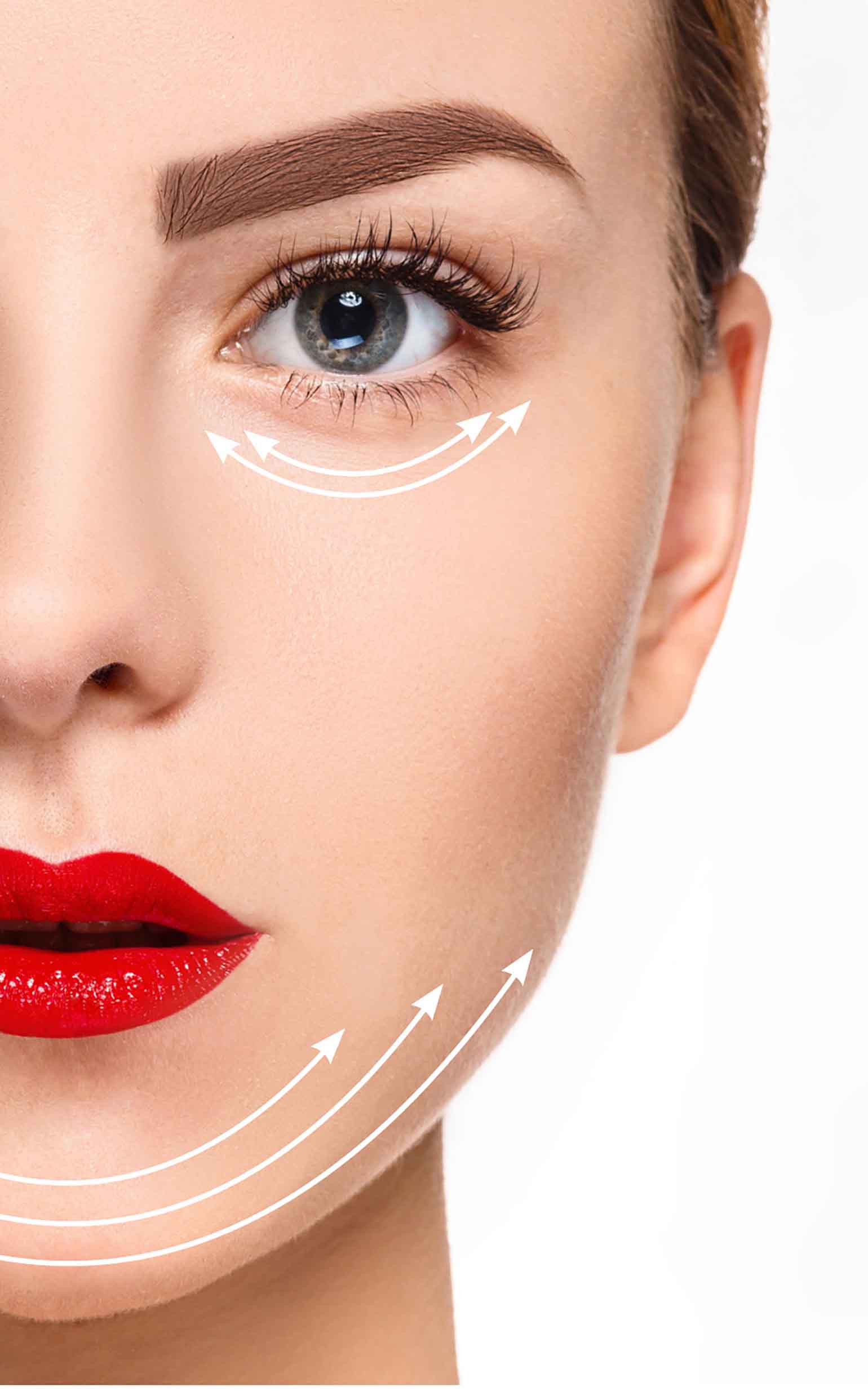 Imagen noticia HILOS TENSORES, DÓNDE SE PUEDEN APLICAR