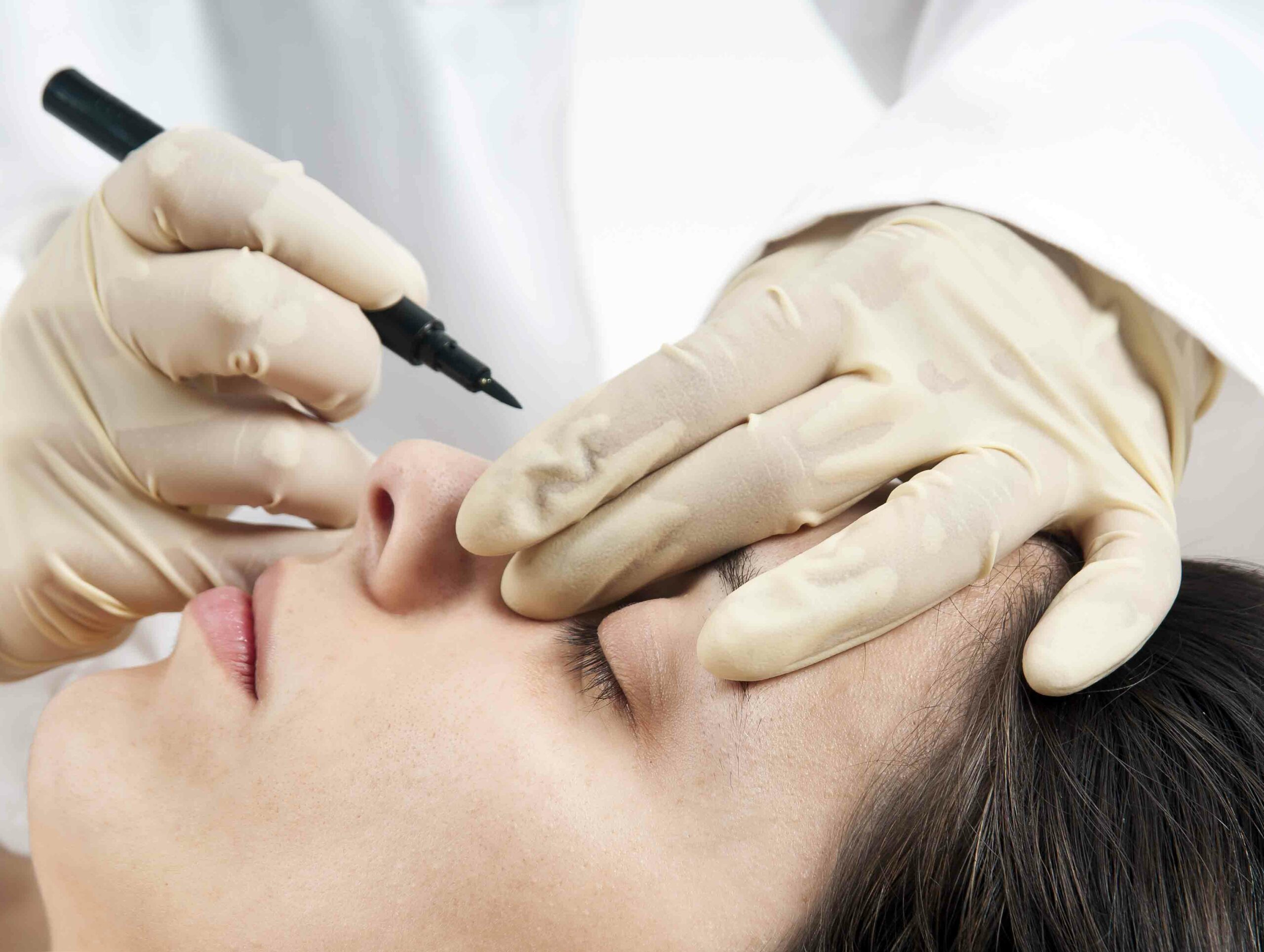 Imagen noticia RINOPLASTIA