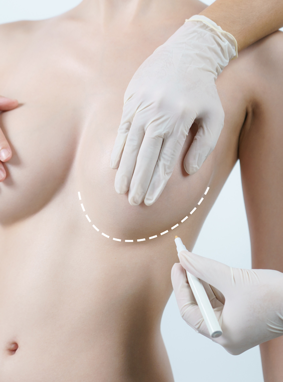 Imagen noticia Enfoque actualizado sobre las cirugías de aumento de pecho