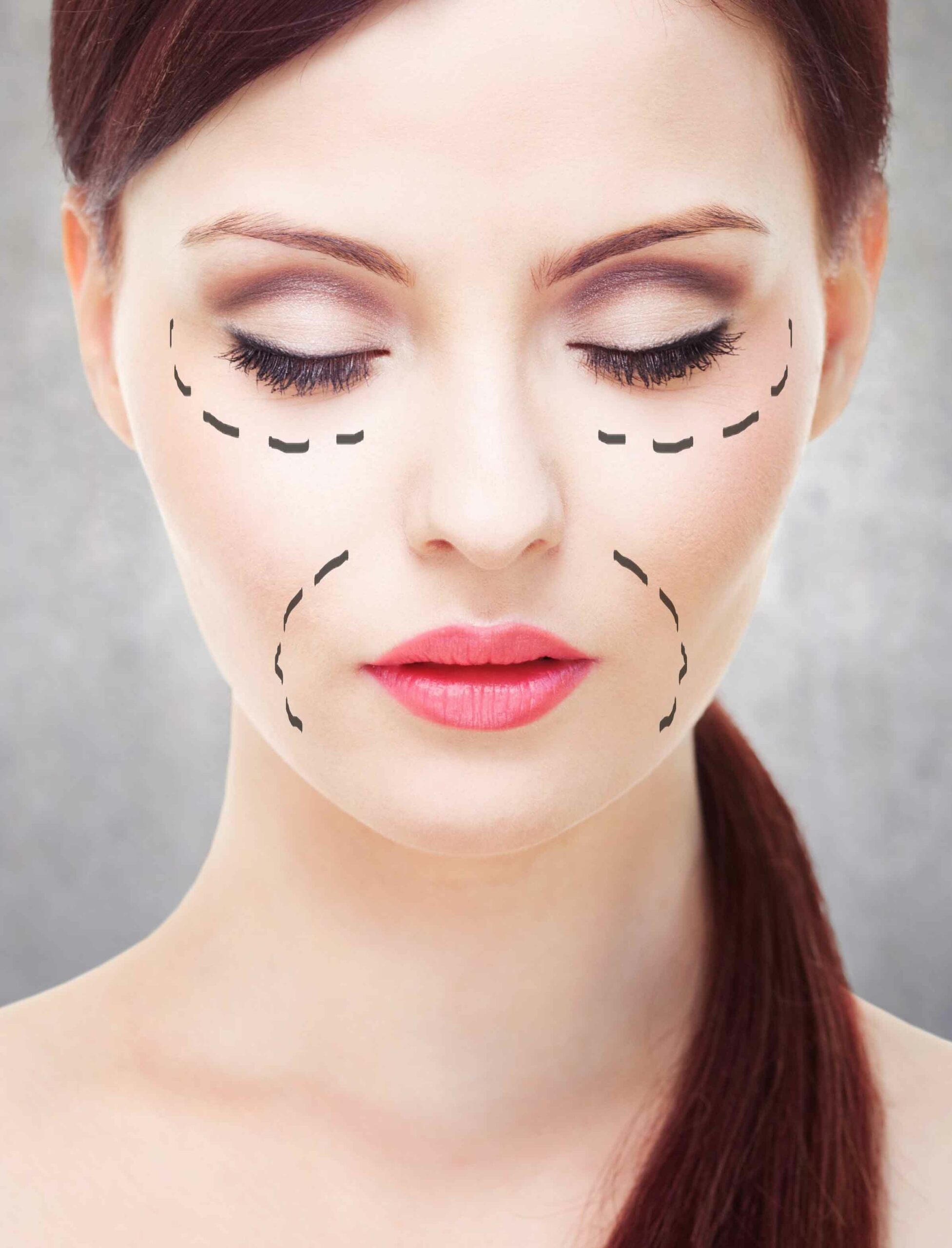 Imagen noticia TÉCNICA DE LOS PUNTOS DE APOYO: REPOSICIÓN DE VOLÚMENES FACIALES