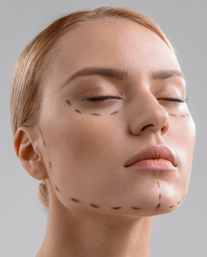 Imagen noticia Procedimientos médicos para definir el ÓVALO FACIAL