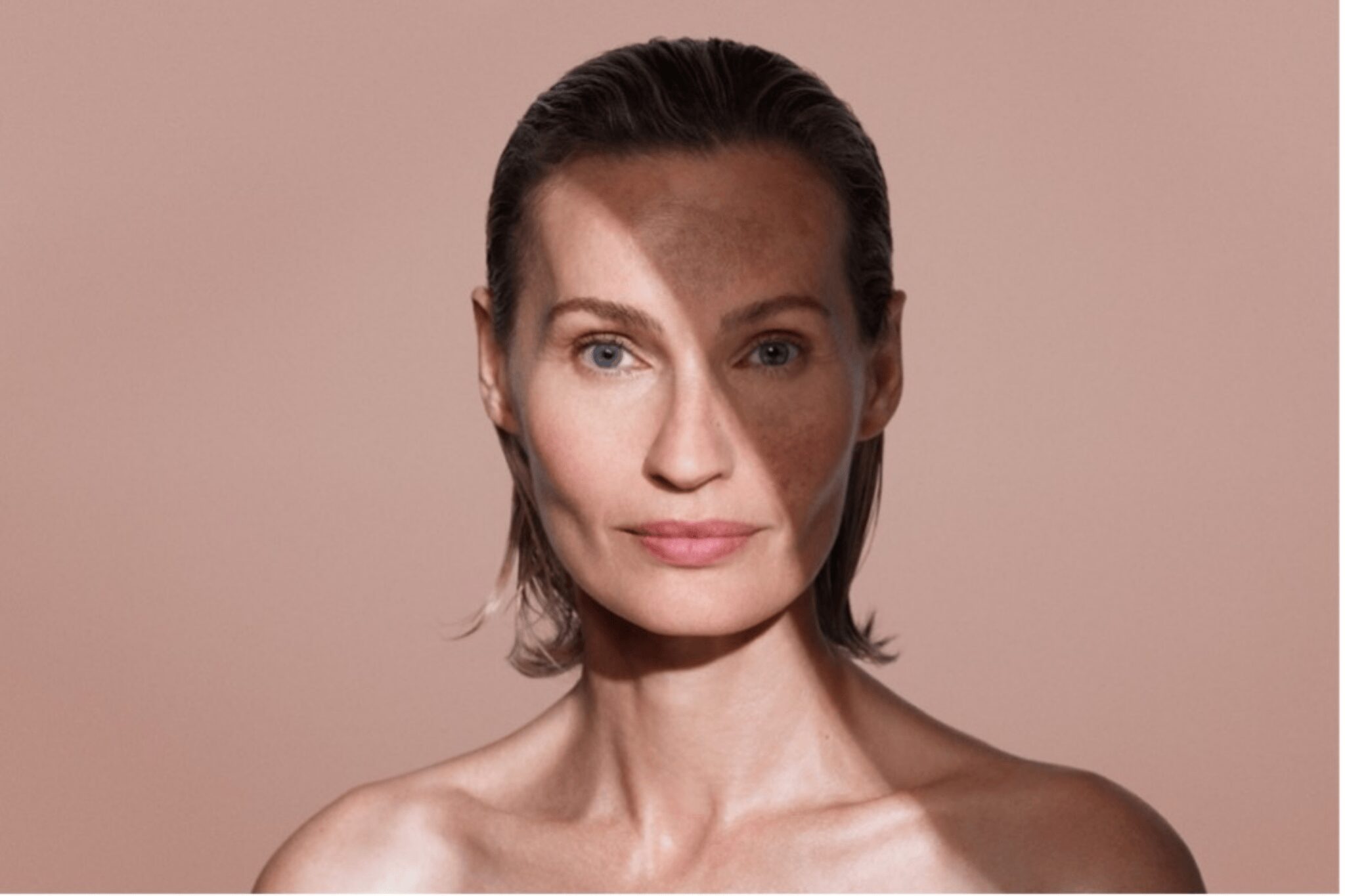 Mujer con cara pigmentada