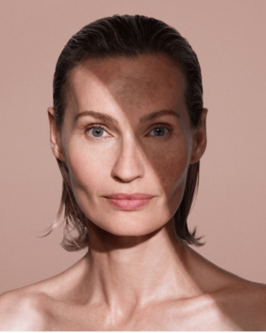 Mujer con cara pigmentada