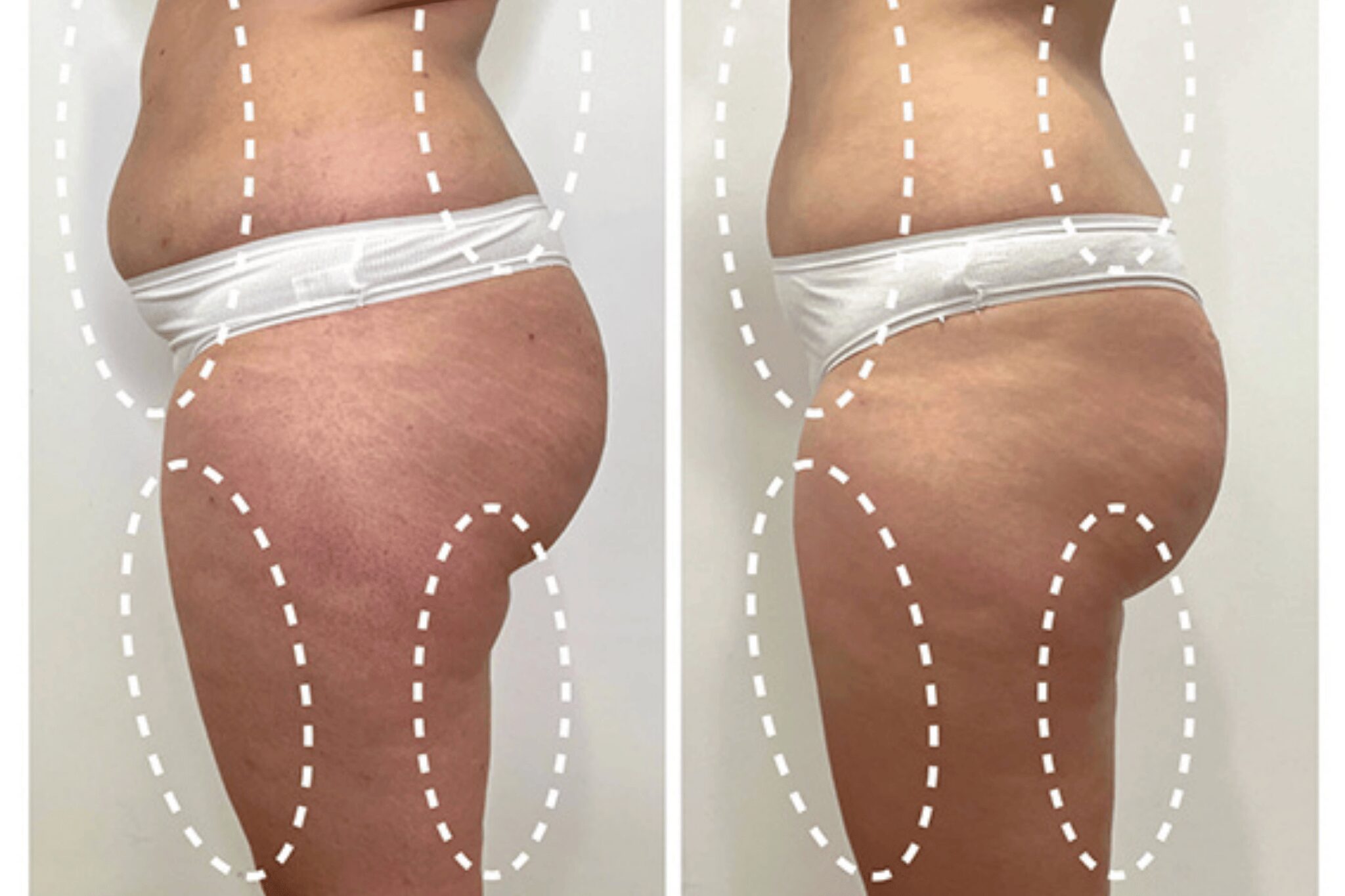 Doctora masajeando la pierna a una clienta con una máquina Zemits