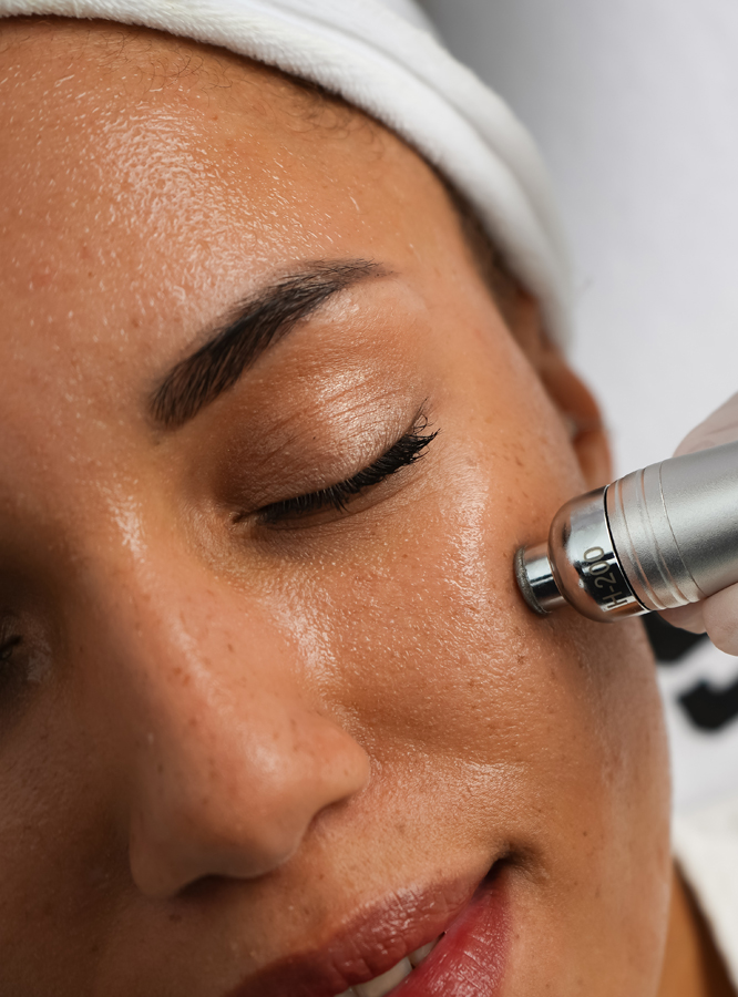 Chica haciendose laser en la cara