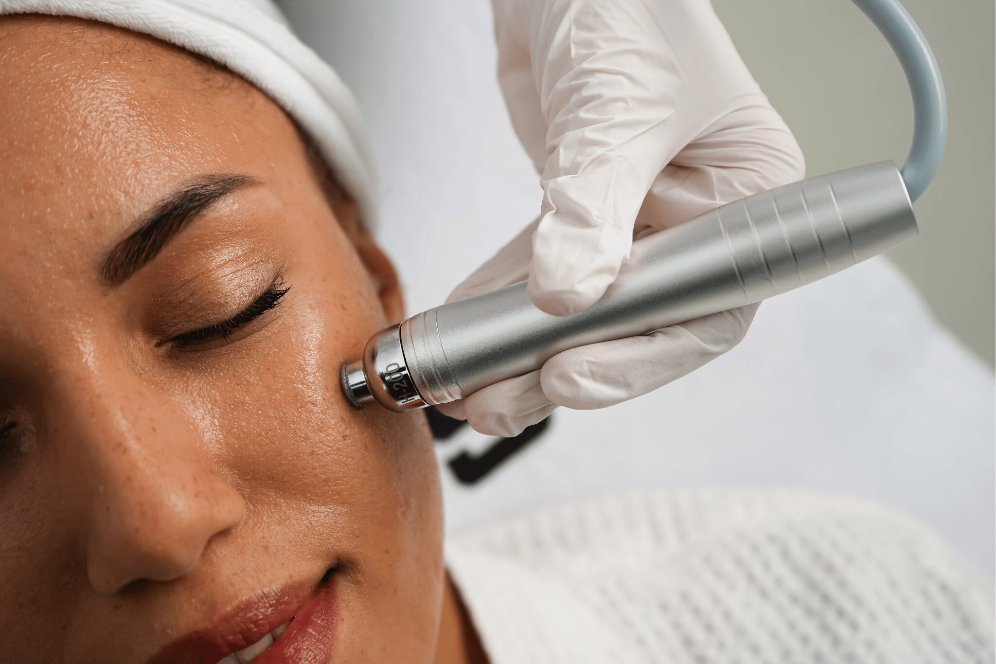 Chica haciendose laser en la cara